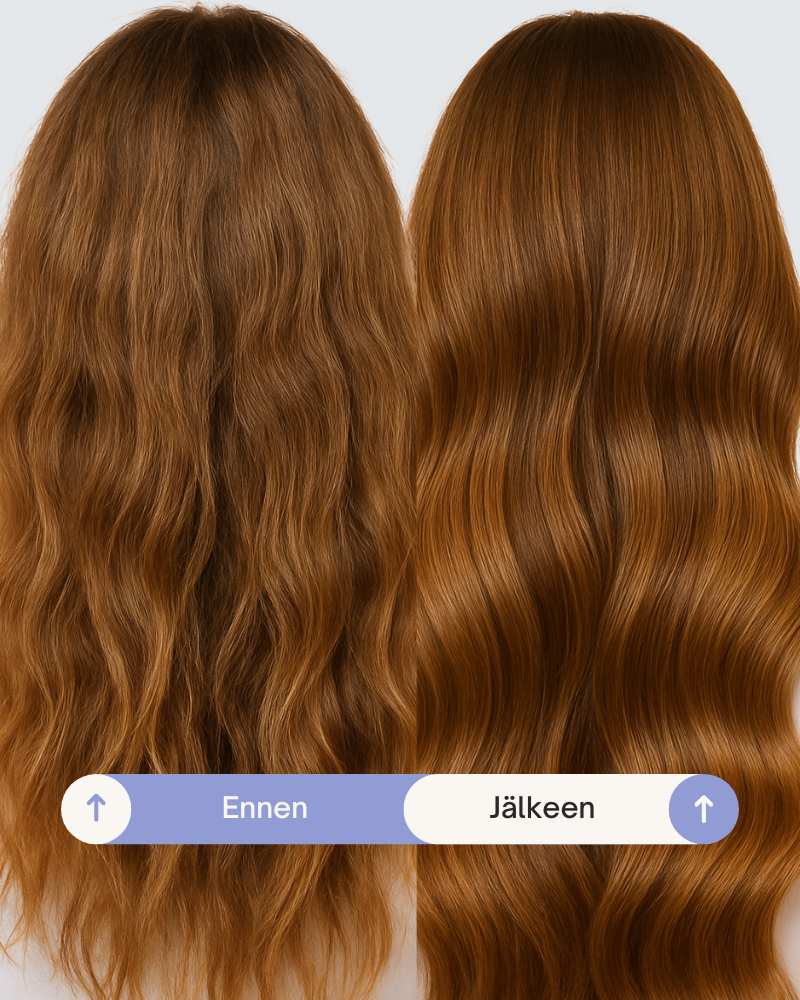Tuotekuva 3
