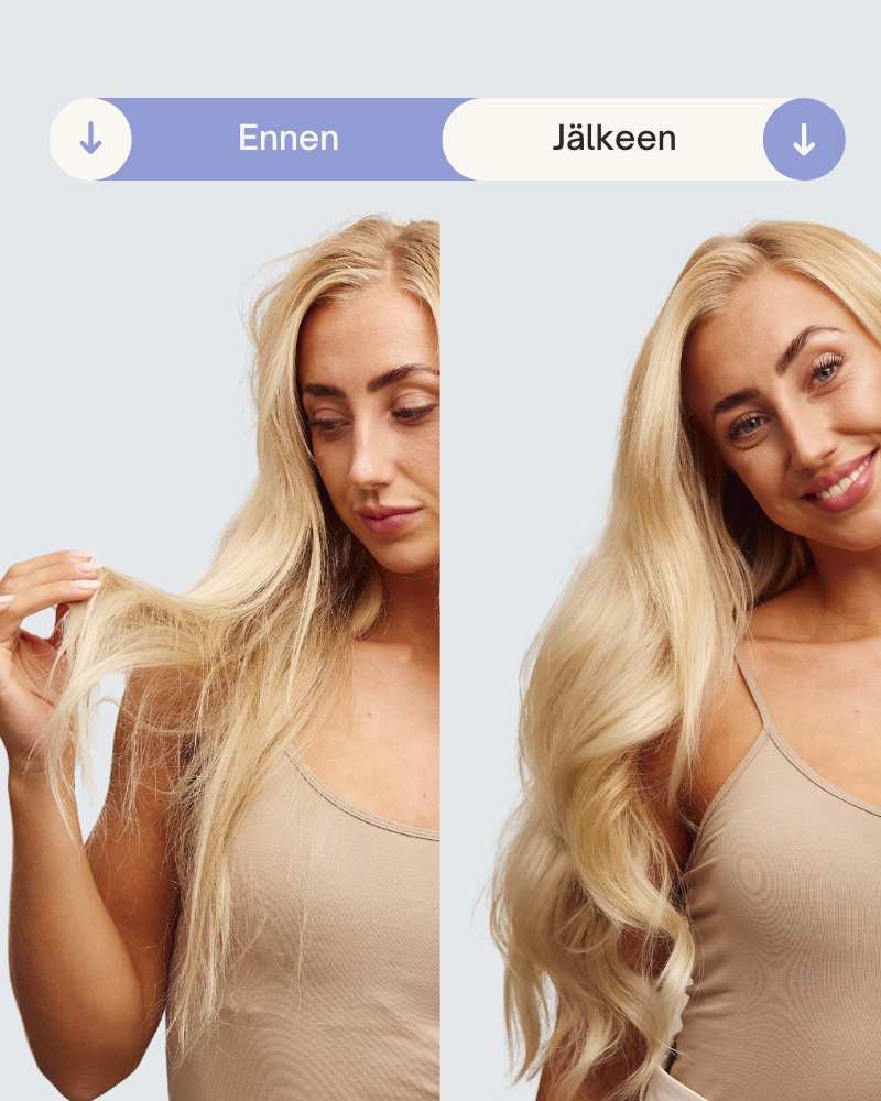 Tuotekuva 3